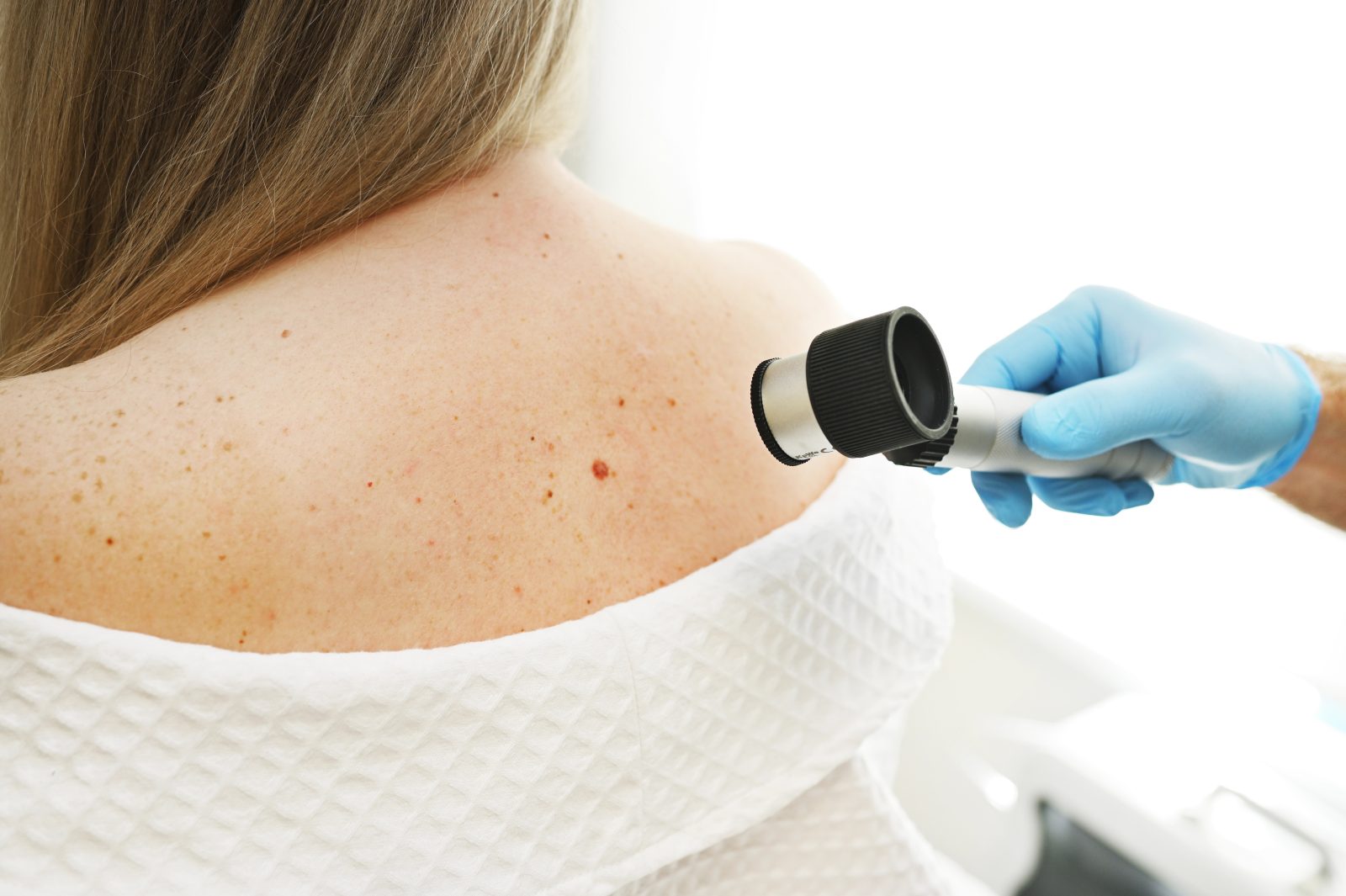 Dermatološka klinika Ljubljana je odlična izbira
